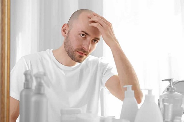 روش درمان ریزش مو مردان