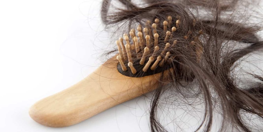 کم پشت شدن مو در زنان